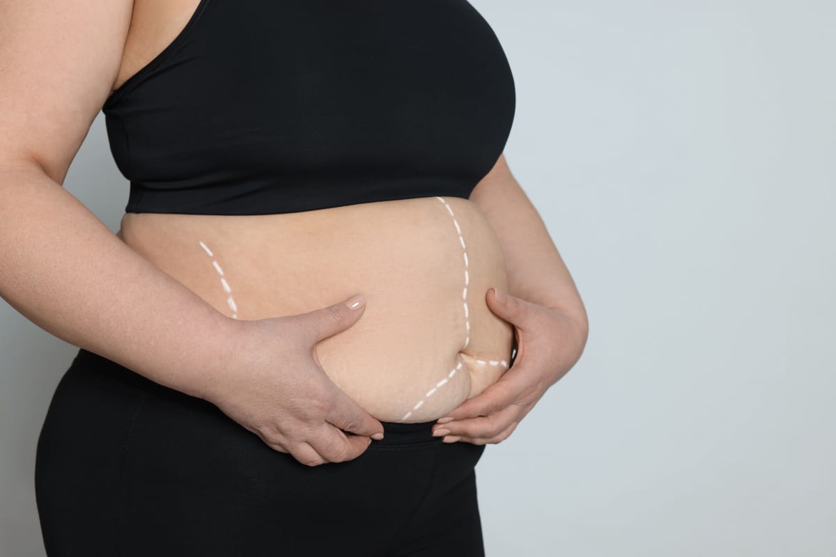 Tratamento da obesidade e distúrbios metabólicos